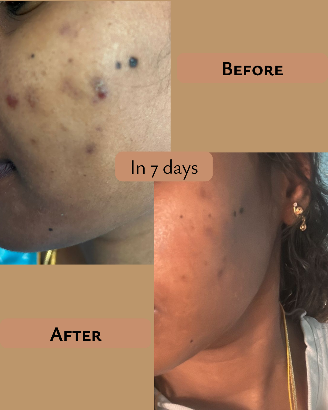 PRAKRTA 9pm Ayurvedic Face Oil for Glowing skin & Bright radiance